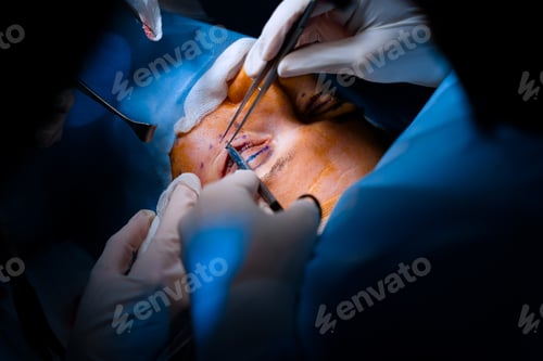 Preview: Cosmetic eyelid surgery with precise surgeon suturing