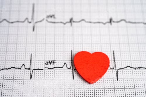 Preview: Electrocardiogram, ECG with red heart, heart wave, heart attack, cardiogram report.