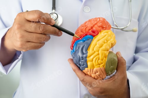 Preview: Alzheimer disease, Asian doctor holding brain anatomy model