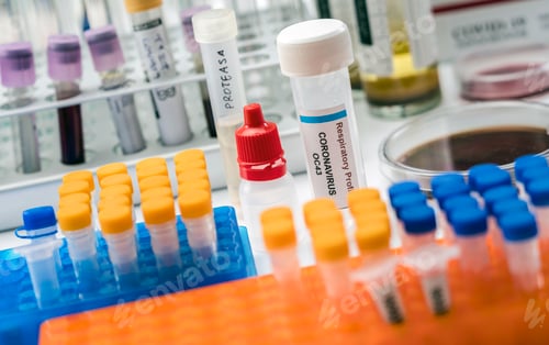 Preview: Vial with soluble protease proteins for activation of the coronavirus