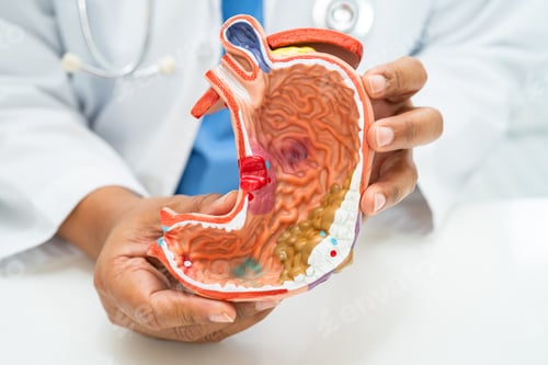 Preview: Stomach disease, doctor with anatomy model for study diagnosis and treatment in hospital.