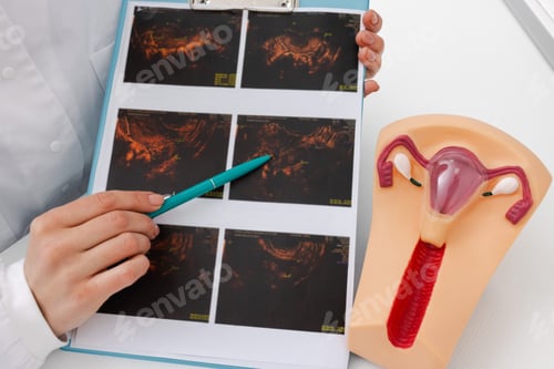 Preview: Doctor showing ultrasound of patient's ovaries next to anatomical model of uterus in her gynecology