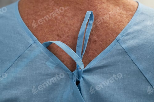 Preview: Close-Up Showing Back of Hospital Patient Gown