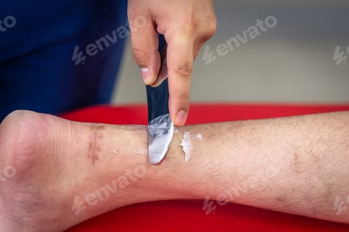 Preview: Instrumental mobilization of soft tissues, heel and arch pain treatment.