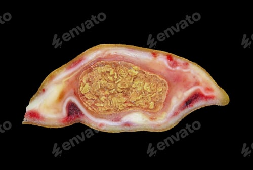 Preview: Close-up of a section in a cyst (tumor) isolated on the black background
