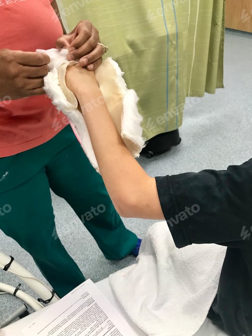 Preview: Removing cast