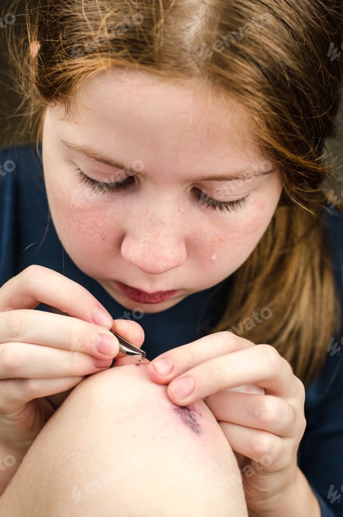 Preview: Girl cries and pulls out the fragments from the wound on her knee.