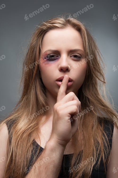 Preview: Half-Length Portrait Of Scared Fair-Haired Young Girl With The Black Eye Wanted But Cannot Tell Us