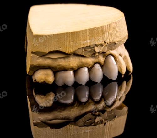 Preview: Ceramic dentures