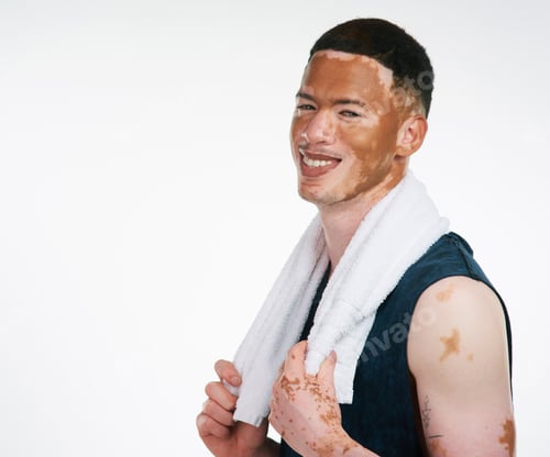 Preview: Cropped portrait shot of a handsome young man with vitiligo working out against a white background