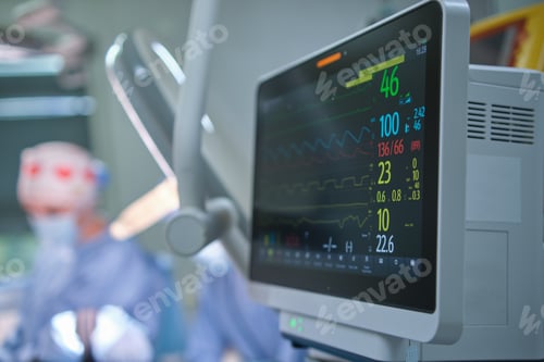 Preview: Heart rate and patient condition control monitor in hospital theater room during surgery operation