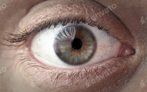 Preview: Open eye