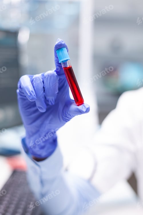 Preview: Scientist researcher woman holding blood vacutainer discovering disease infection