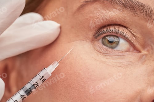 Preview: Beautician hands in protective gloves holding syringe near female eye