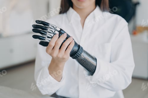 Preview: Handicapped young woman is assembling bionic arm with hand. Girl is adjusting prosthesis.