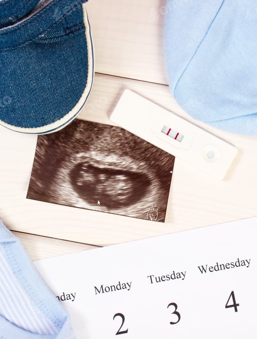 Preview: Pregnancy test, ultrasound scan of baby, clothing for newborn and calendar, expecting for baby