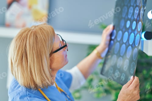 Preview: Woman doctor checking diagnosis on film image