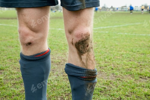 Preview: Footballer with cut and muddy knees