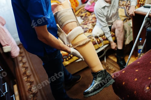 Preview: The prosthetist removes the measure from a person with a disability, man with amputee.