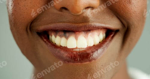 Preview: Person, african and closeup with teeth, smile and dental care and oral hygiene or health. Mouth, zo