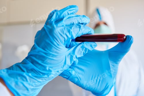 Preview: Blood Test For Blood Test On Covid-19 To Research For Vaccine In The Laboratory