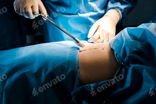 Preview: cropped view of surgeon doing operation and holding tampon