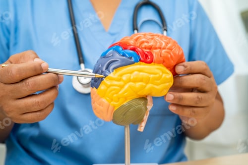 Preview: Alzheimer disease, Asian doctor holding brain anatomy model for study diagnosis and treatment