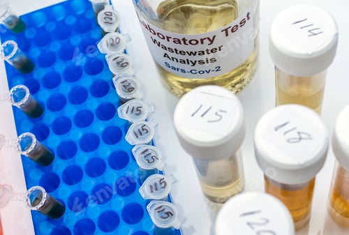 Preview: Wastewater samples, analysis of sars-cov-2 virus in patients infected by human coronavirus 229E