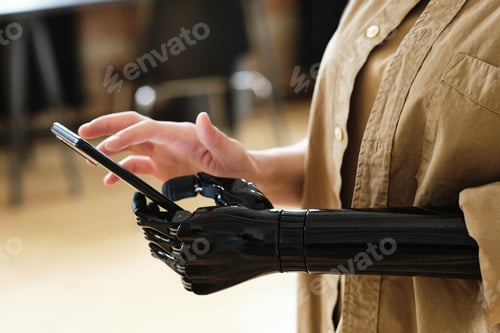 Preview: Girl with prothesis using mobile phone