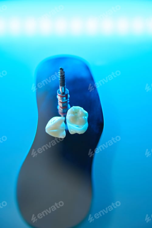 Preview: Close-up of pin and chewing teeth. Restoration of damaged teeth