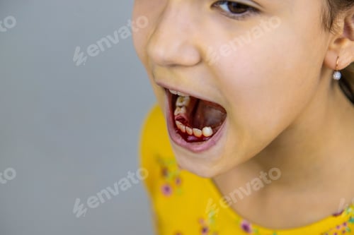 Preview: Pull out a child tooth. Selective focus.
