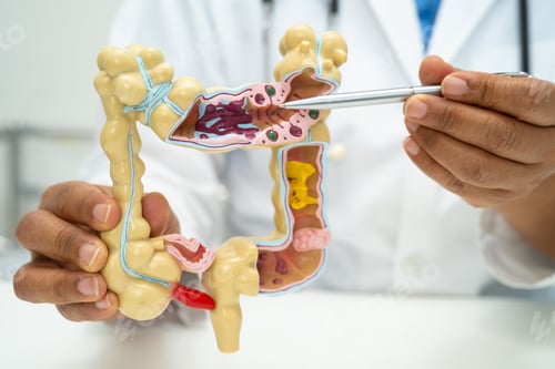 Preview: Intestine, appendix and digestive system, doctor holding anatomy model for study diagnosis
