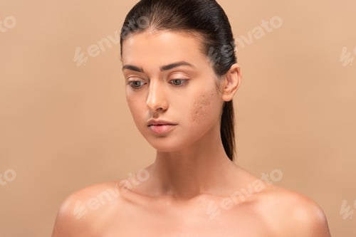 Preview: young naked woman with problem skin isolated on beige