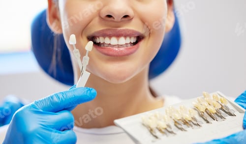 Preview: My dentist only uses the best