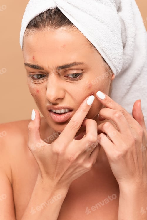 Preview: displeased girl in towel squeezing pimple isolated on beige