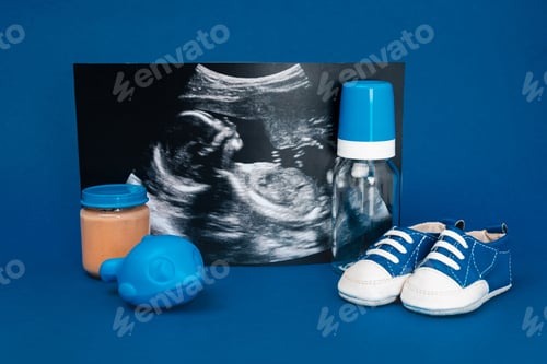Preview: ultrasound scan, baby bottle, toy, baby shoes, jar with baby food ob blue background