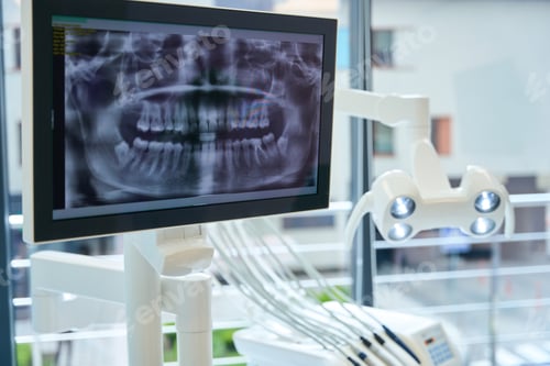 Preview: Monitor with the image of a dental x-ray