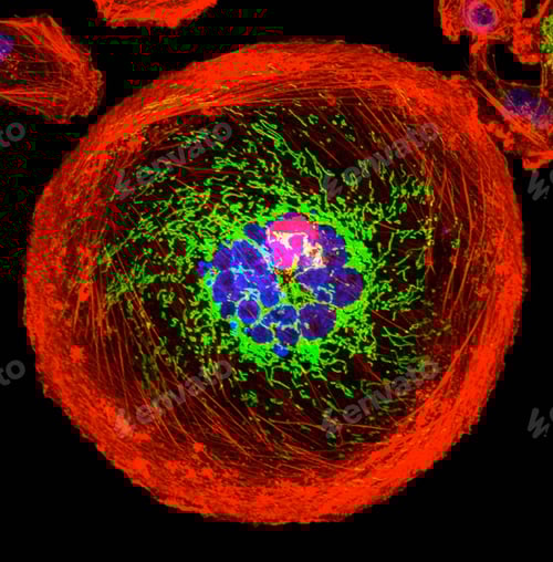Preview: Microscopic image of polyploid giant cancer cell
