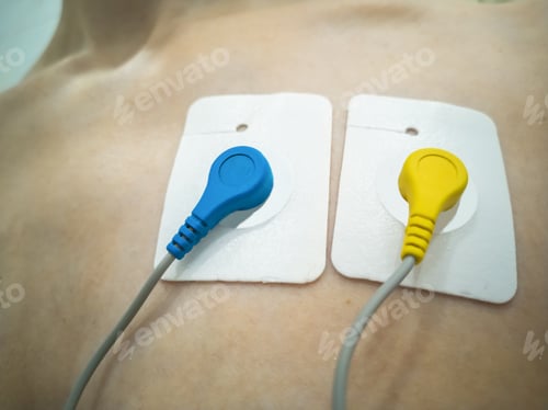 Preview: 24-hour ECG recording. Holter monitoring. Blue and yellow Holter sensors - heart with Ukraine.