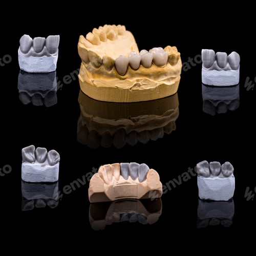 Preview: Artificial tooth