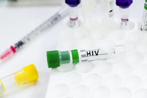 Preview: High angle shot of empty blood test sample tube on white background