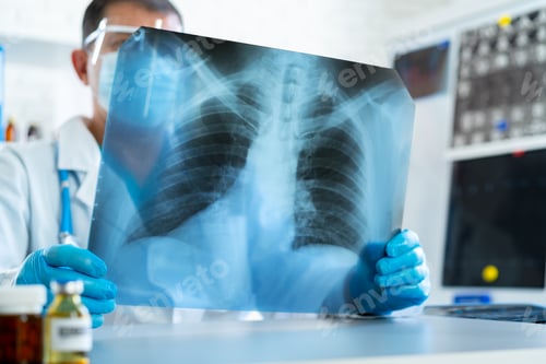 Preview: Doctor examining lungs x-ray scan in his office in hospital