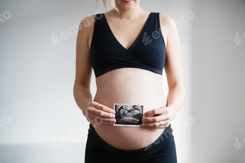 Preview: Pregnant woman holding ultrasound baby image. Pregnant belly and sonogram photo