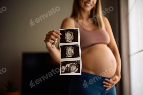 Preview: Close up of pregnant woman holding ultrasound of her baby.