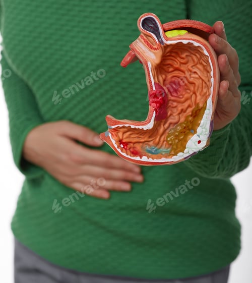 Preview: Woman with pain in stomach area holding anatomical model of stomach with pathology. Medical