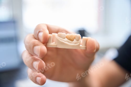 Preview: Specialist demonstrates a model for dental prosthetics