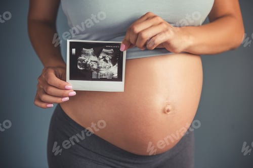 Preview: Beautiful pregnant woman