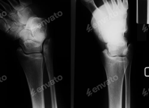 Preview: Details of X Ray Frame from Hospital
