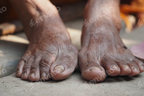 Preview: Close-up of aged feet revealing unique textures and stories