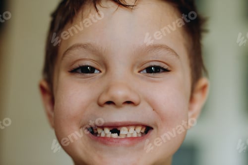 Vista previa: Lindo niño sonriendo demostrando la pérdida de un diente de leche
